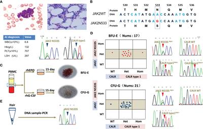 A germline JAK2 exon12 mutation and a late somatic CALR mutation in a patient with essential thrombocythemia